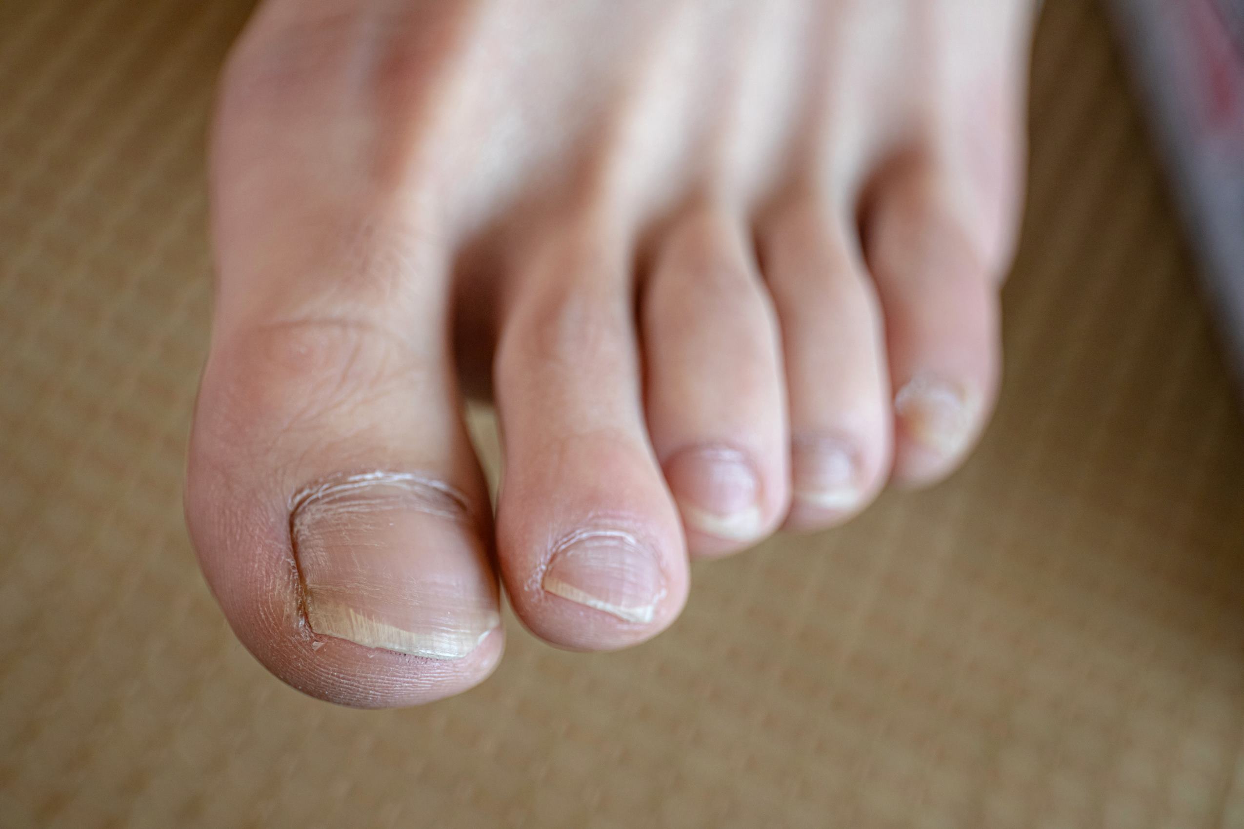 图片[126]-[MZSOCK]爱美足 NO.277 海椒[149P] – 速更版-美库