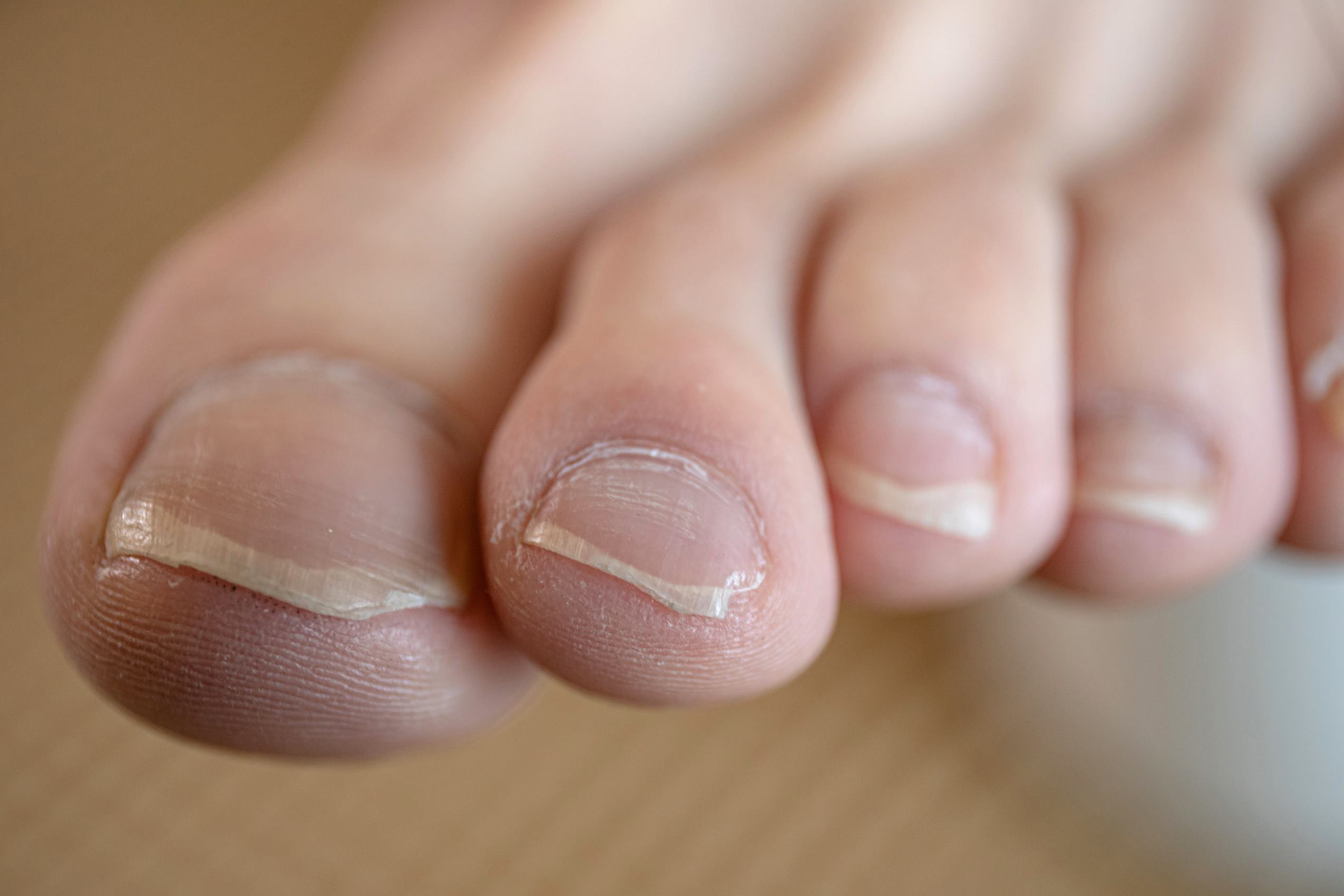 图片[127]-[MZSOCK]爱美足 NO.277 海椒[149P] – 速更版-美库