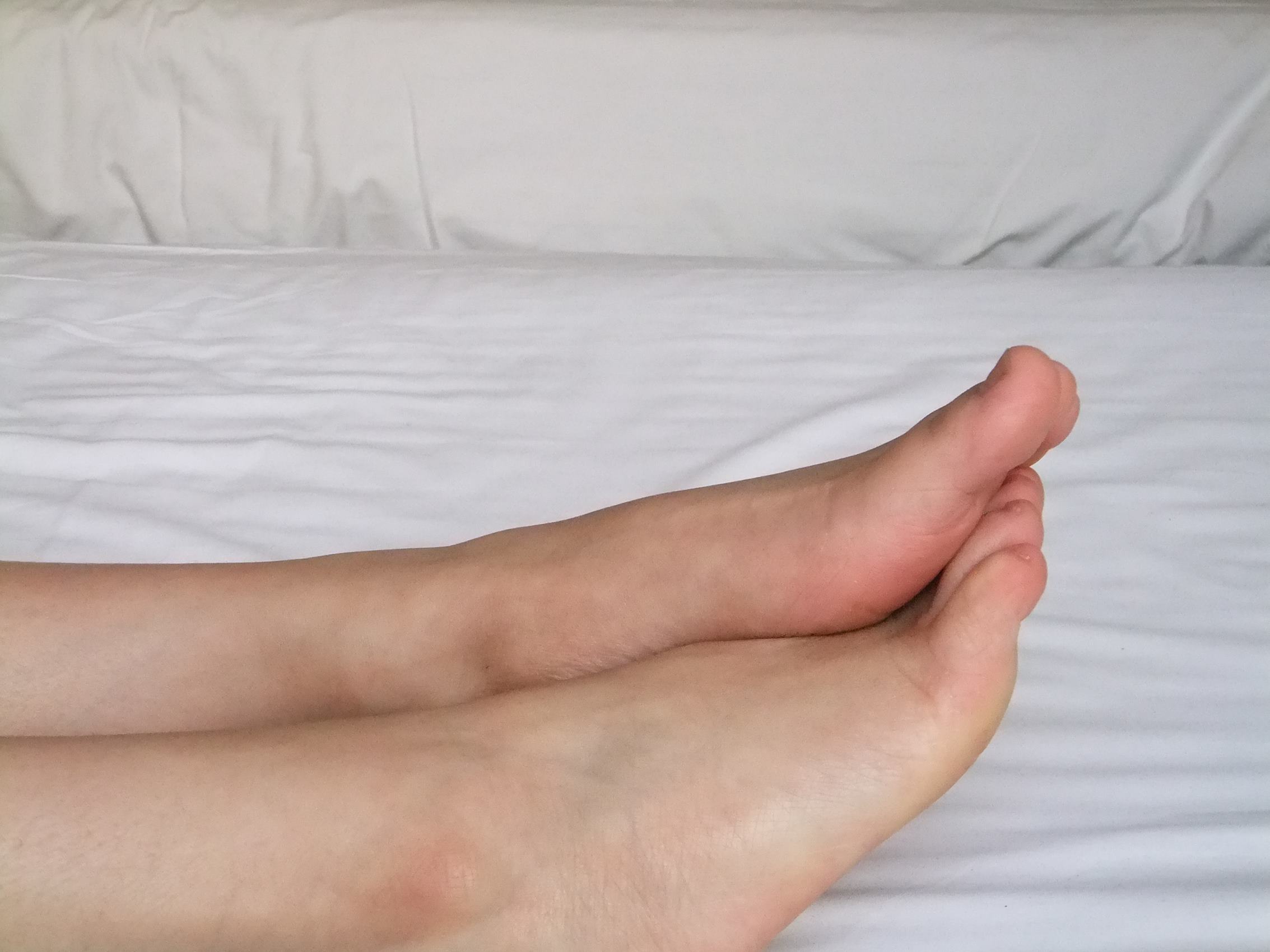 图片[46]-自由摄影 No.211 红嫩的玉足，白白的长腿 [82P] – 速更版-美库