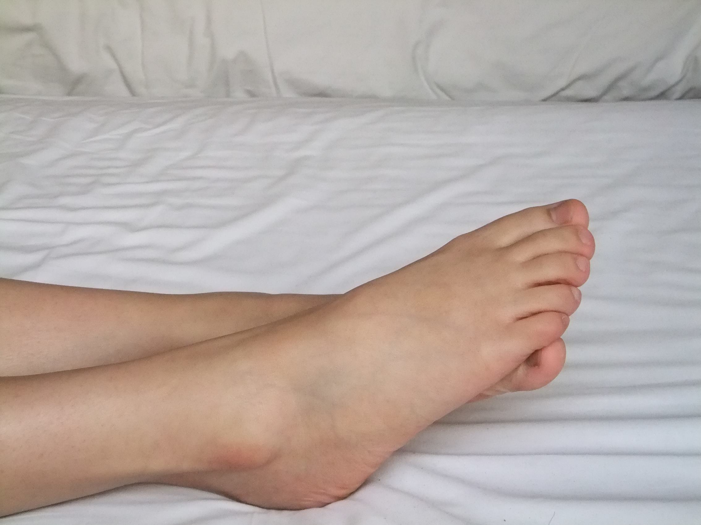 图片[62]-自由摄影 No.211 红嫩的玉足，白白的长腿 [82P] – 速更版-美库