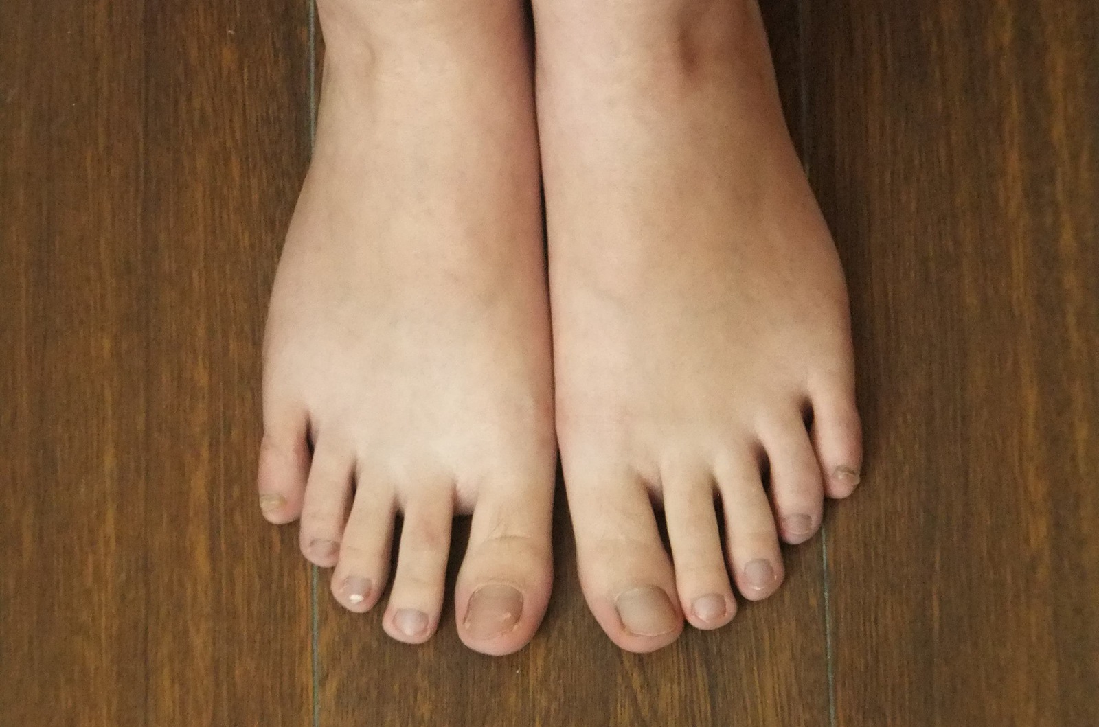 图片[40]-自由摄影 No.225 裸足爱好者 [97P] – 速更版-美库