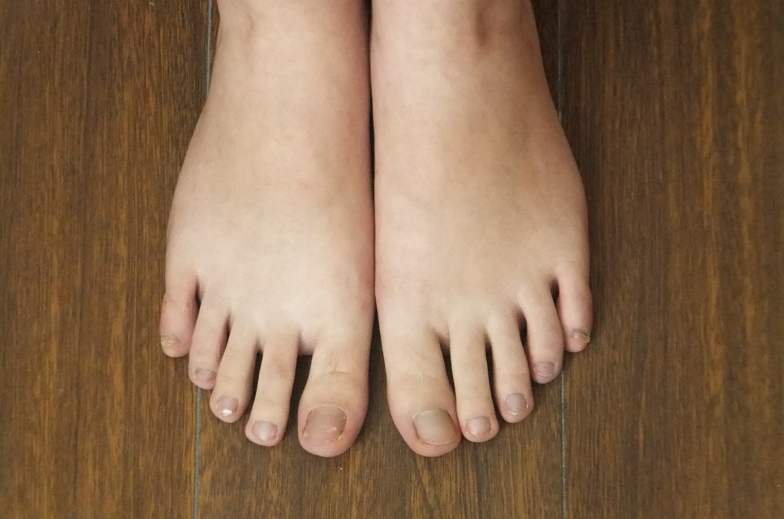 图片[44]-自由摄影 No.225 裸足爱好者 [97P] – 速更版-美库