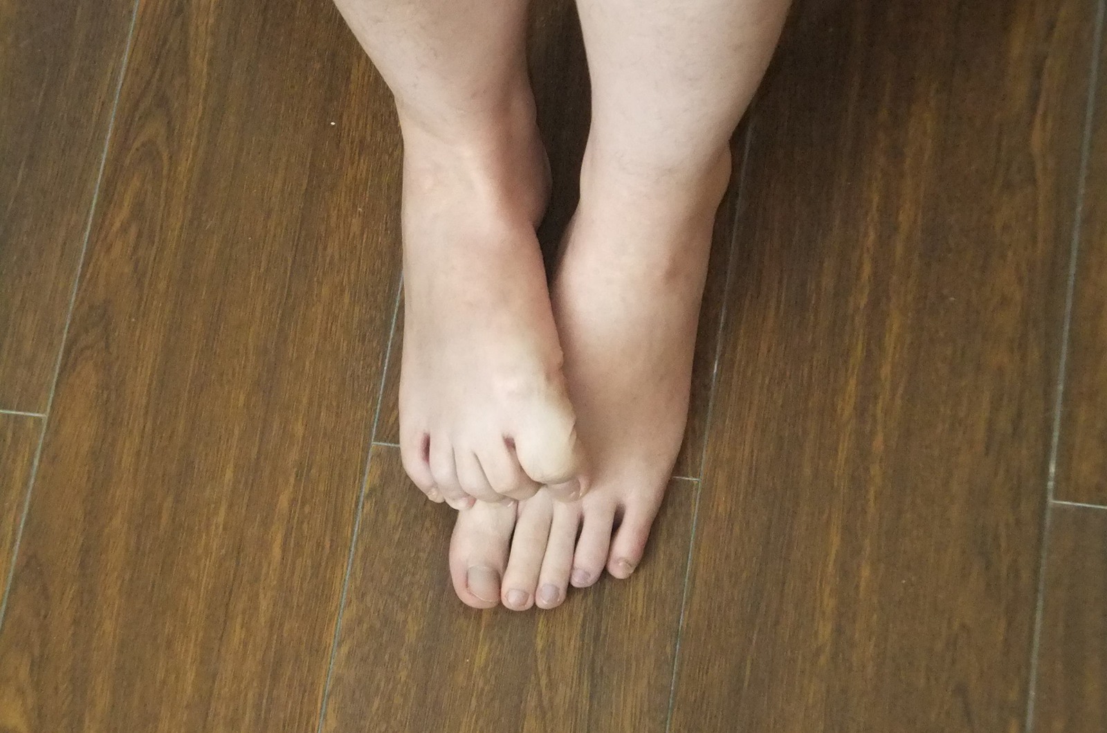 图片[46]-自由摄影 No.225 裸足爱好者 [97P] – 速更版-美库