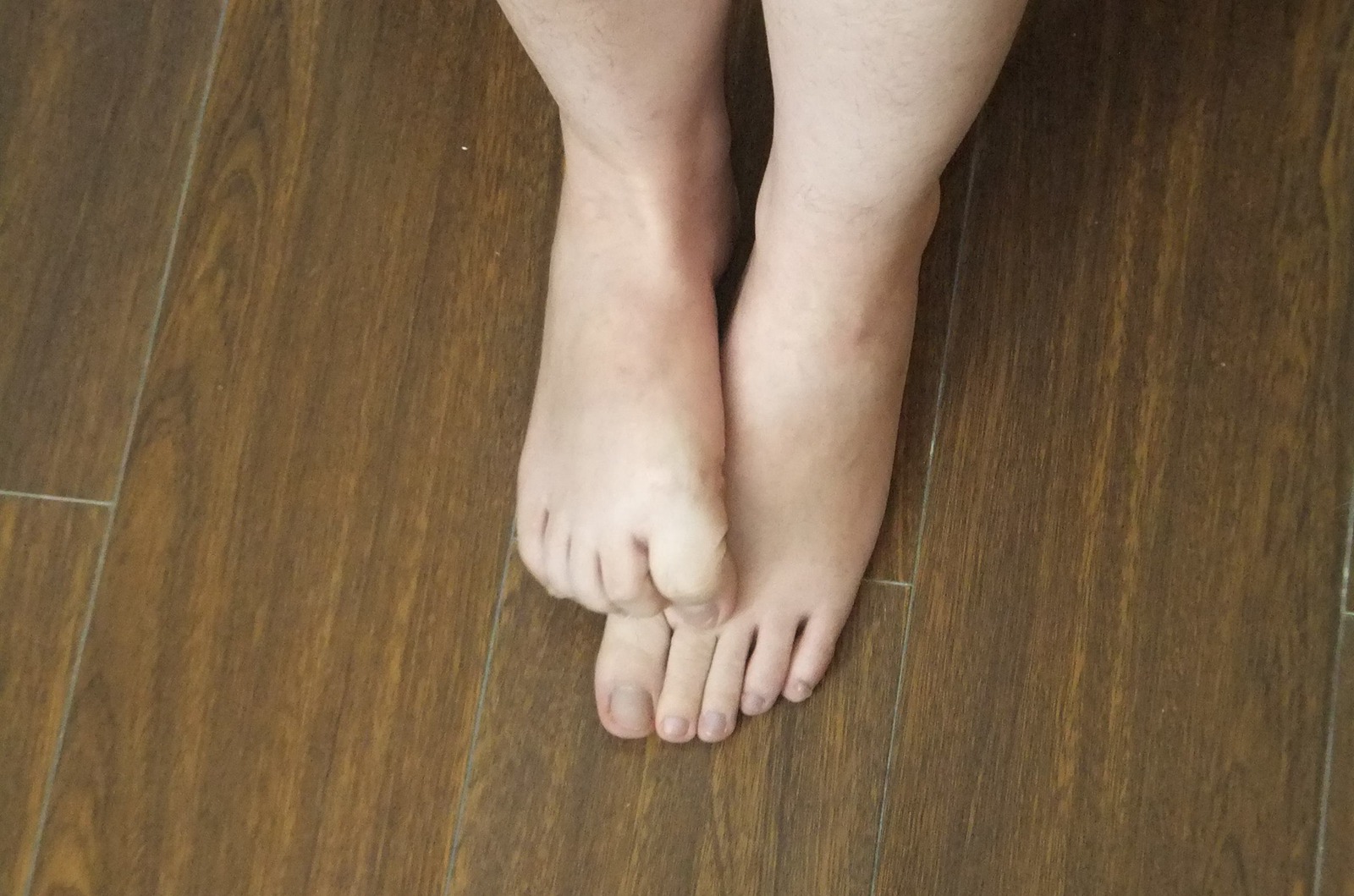 图片[48]-自由摄影 No.225 裸足爱好者 [97P] – 速更版-美库