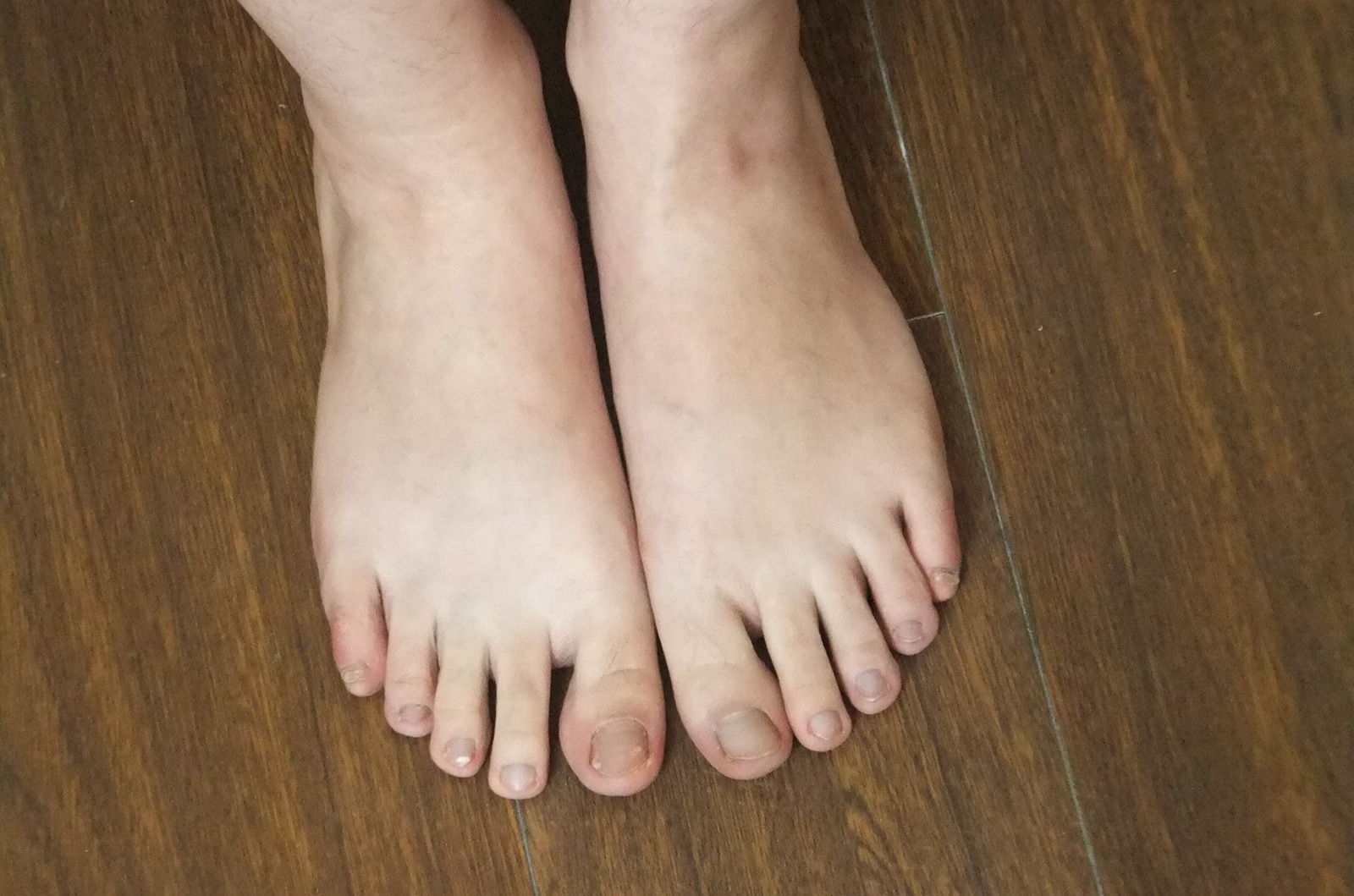 图片[82]-自由摄影 No.225 裸足爱好者 [97P] – 速更版-美库