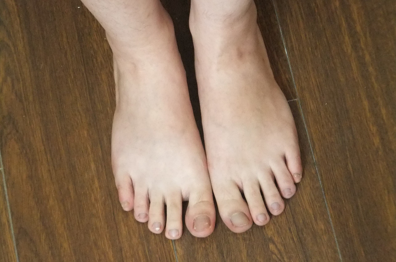 图片[83]-自由摄影 No.225 裸足爱好者 [97P] – 速更版-美库