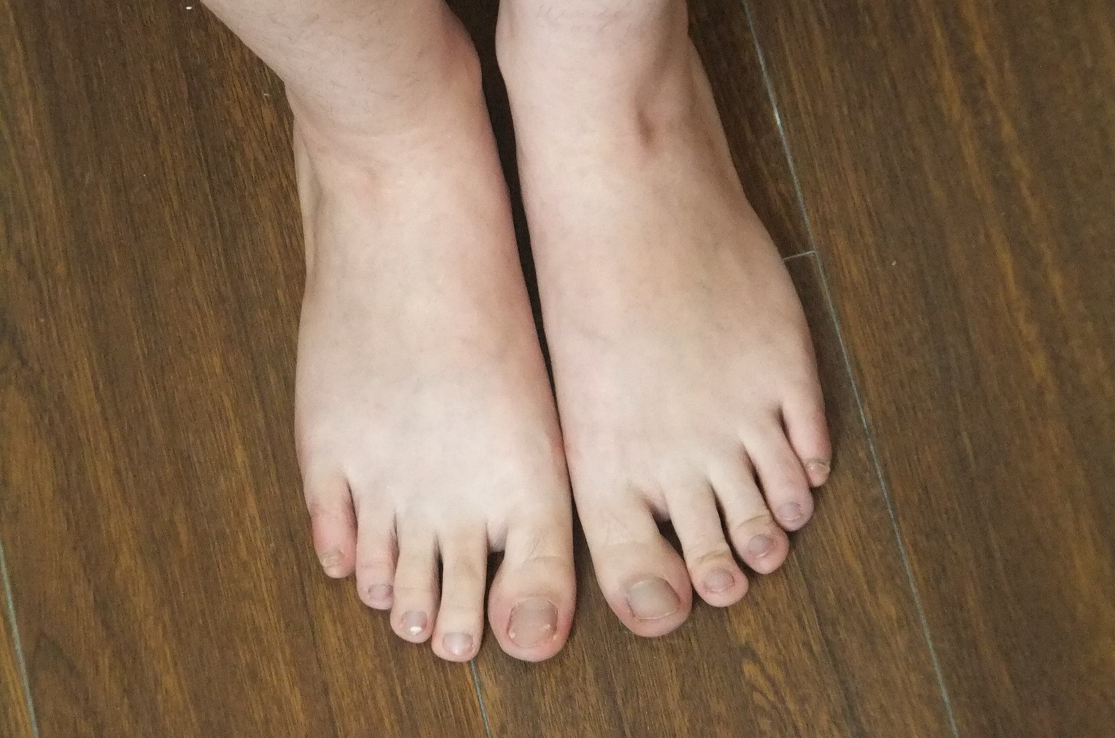 图片[85]-自由摄影 No.225 裸足爱好者 [97P] – 速更版-美库