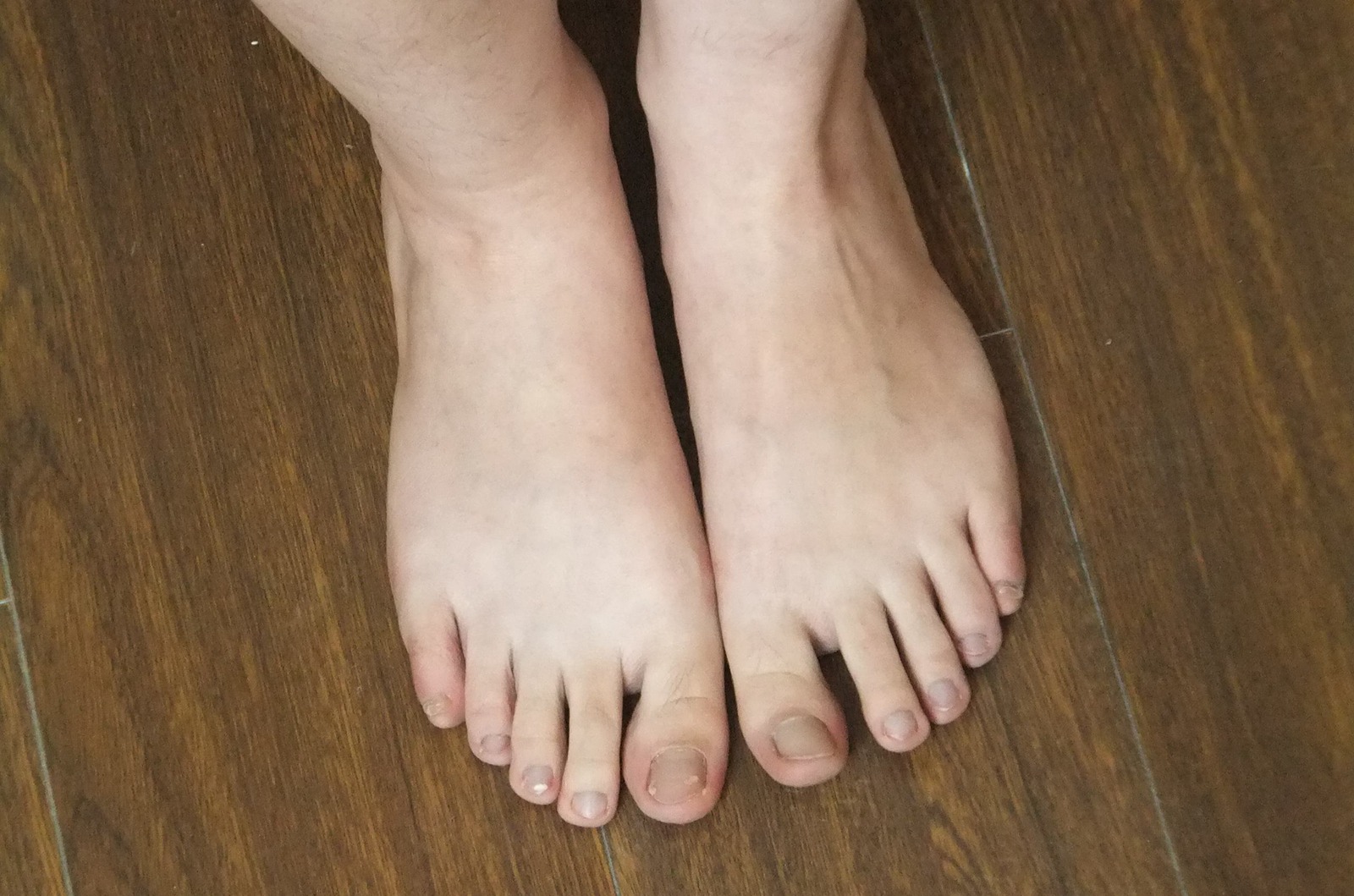 图片[86]-自由摄影 No.225 裸足爱好者 [97P] – 速更版-美库