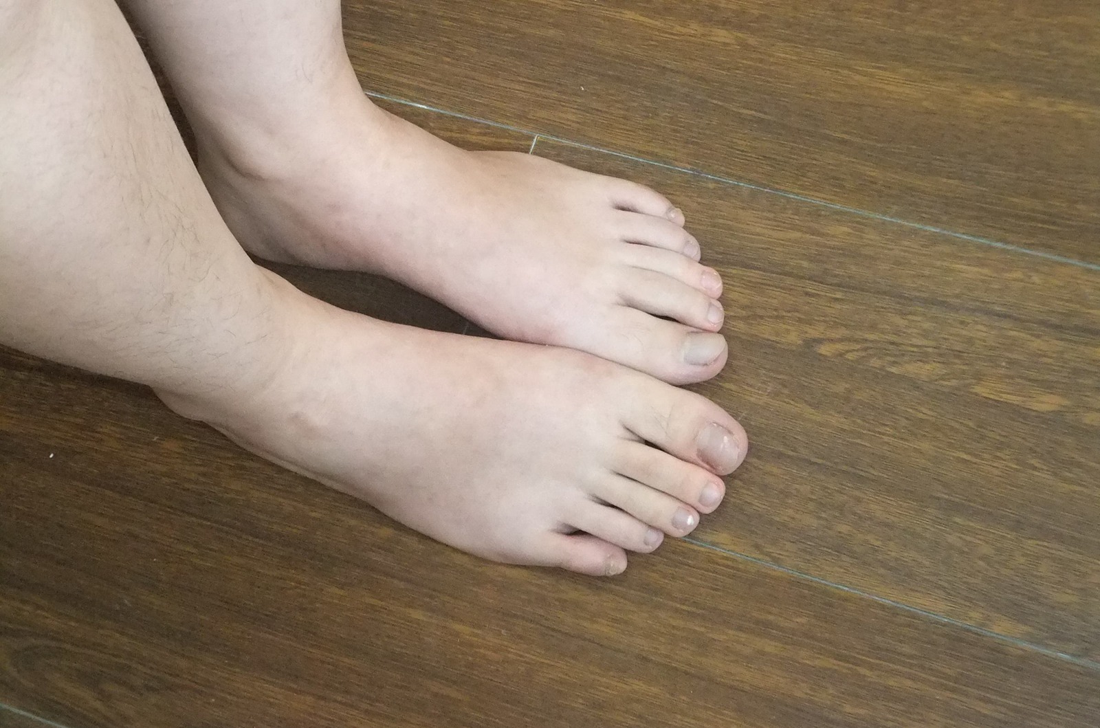 图片[96]-自由摄影 No.225 裸足爱好者 [97P] – 速更版-美库