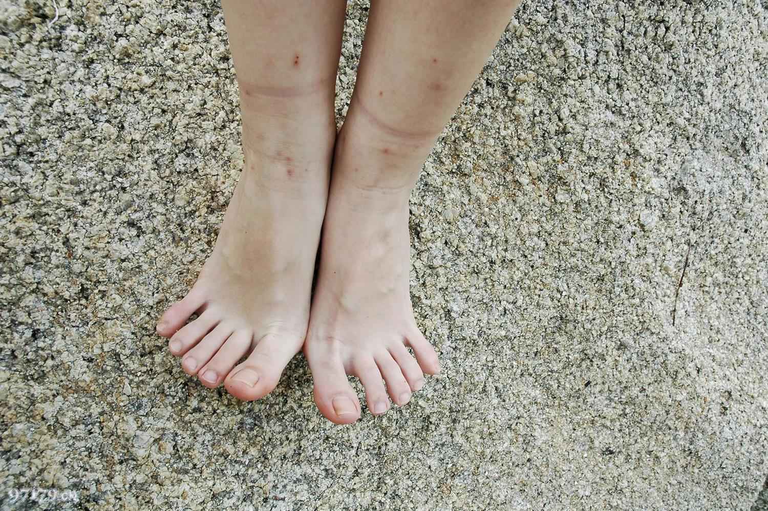 图片[17]-97179 NO.003-Skina[43P] – 速更版-美库