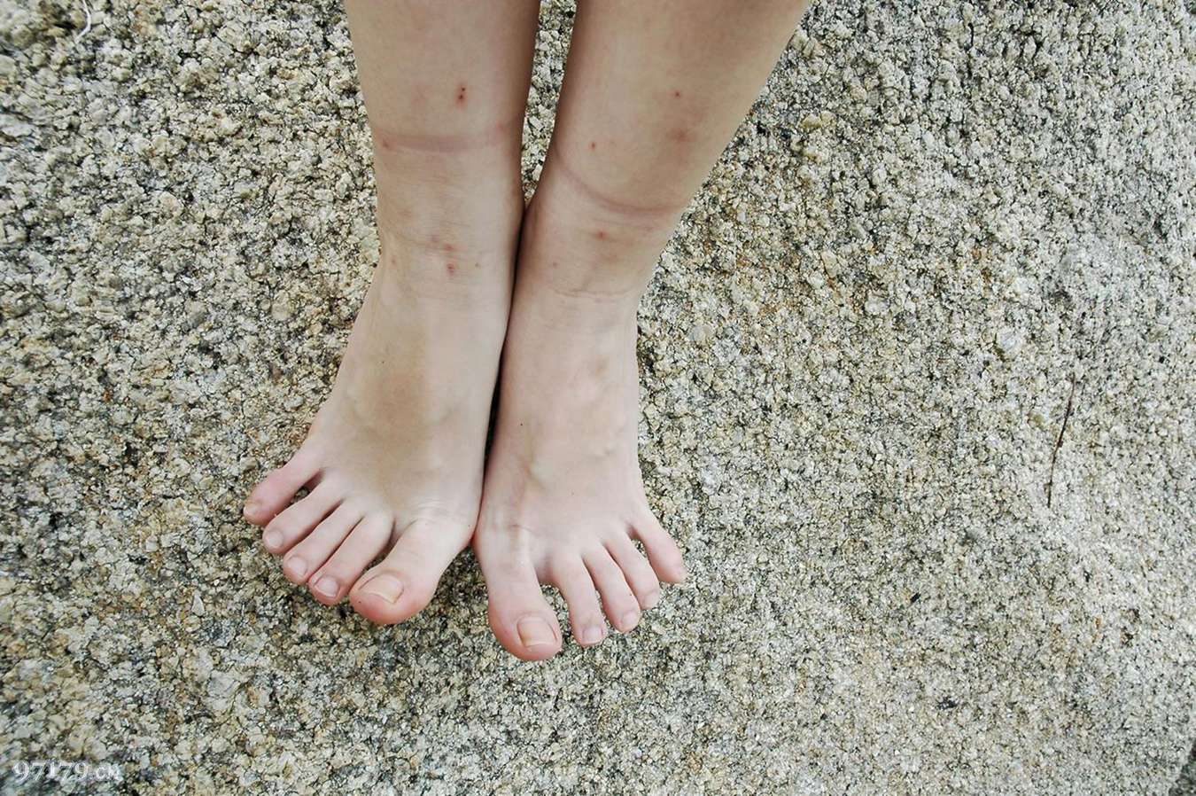 图片[17]-97179 NO.003-Skina 第三部[43P] – 速更版-美库