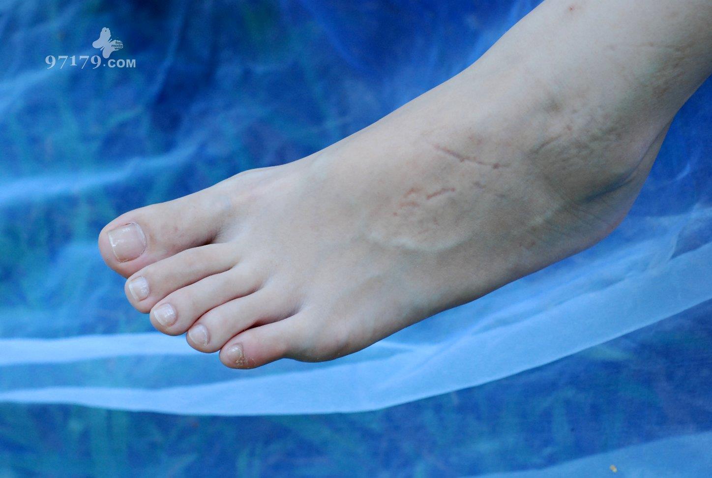 图片[12]-97179 NO.011-Skina 第十一部[34P] – 速更版-美库