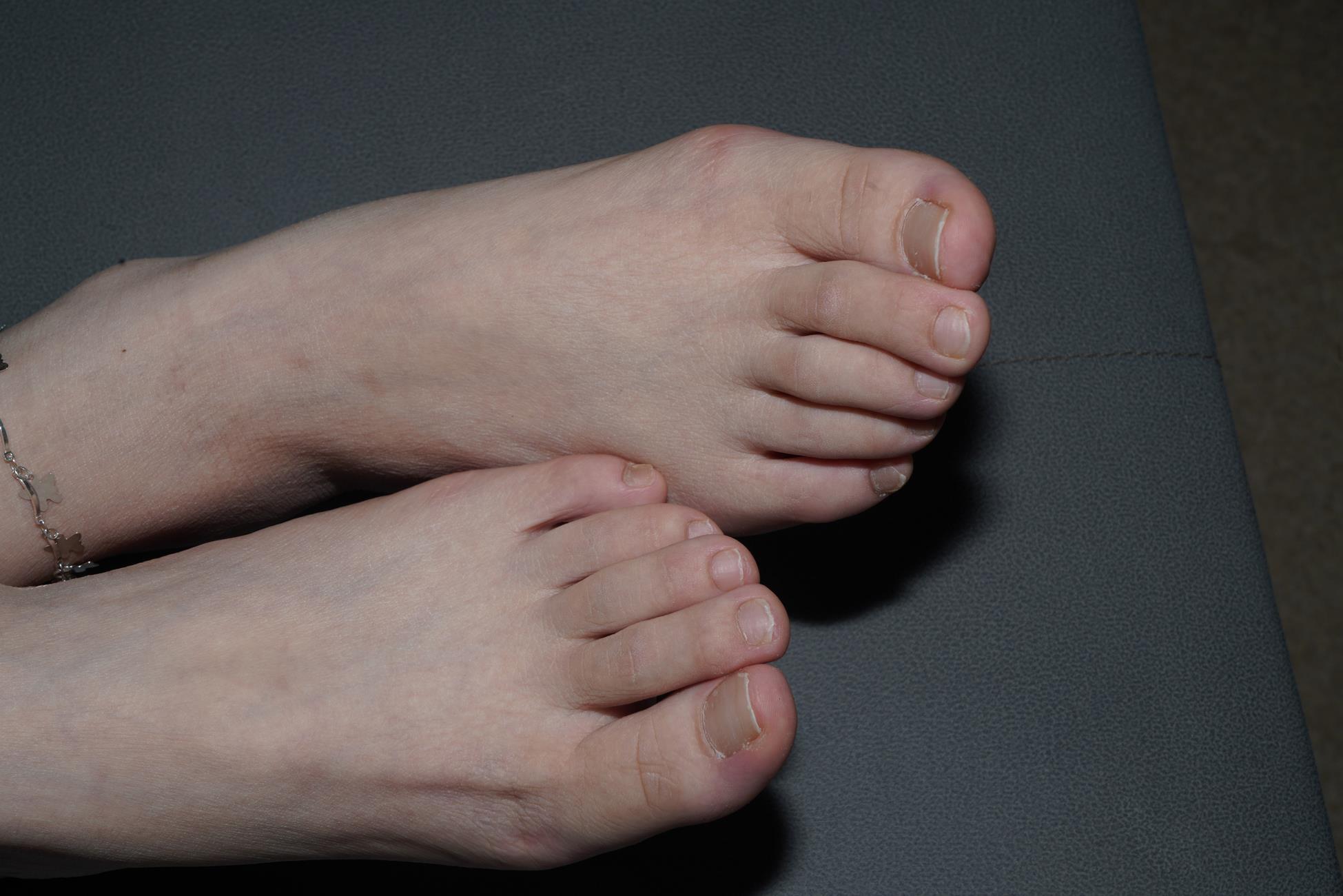 图片[31]-Pary摄影 NO.153 新模小美女炜玲展示36码超白小脚[88P] – 速更版-美库