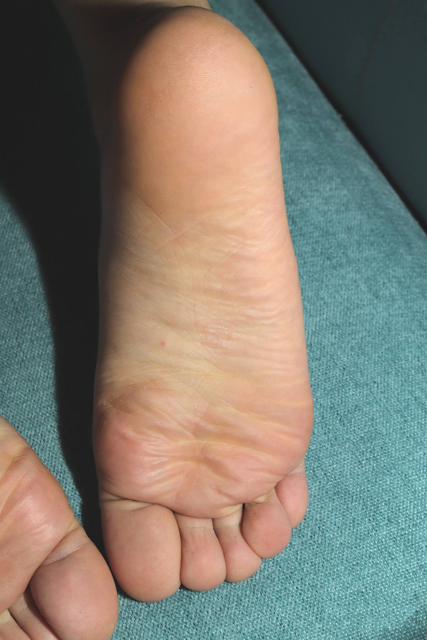 图片[60]-Pary摄影 NO.156 燕玲“医生”展示36码可爱小嫩脚 下集[69P] – 速更版-美库