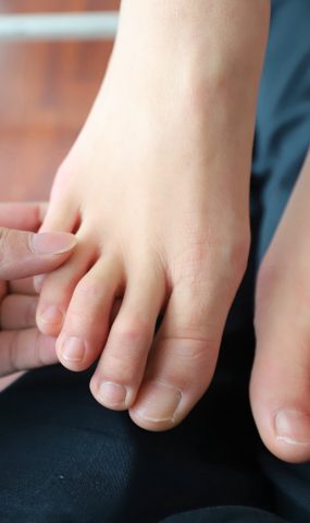 大西瓜爱牙膏-2019 4月活动 模特1（一） 足 [78P]