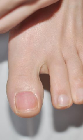 Fannie芬妮每足园 No.298 裸足特辑5 [30P]