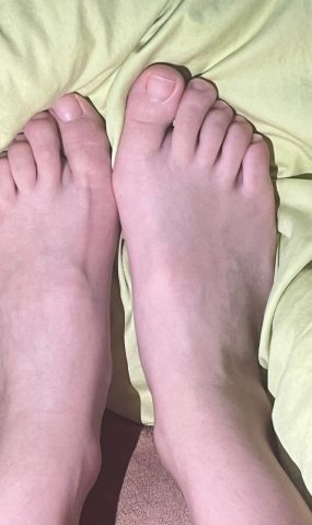 脚模面试脸足同框套路系列-078-高颜值红白脚[4P]