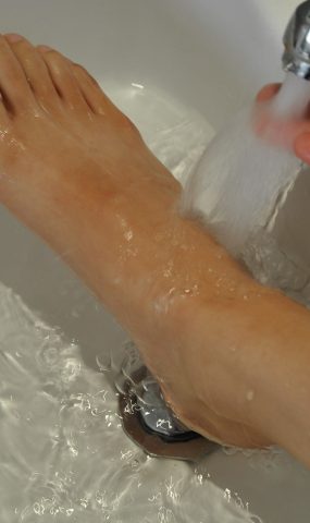 自由摄影 No.170 受伤了玉足 [51P]